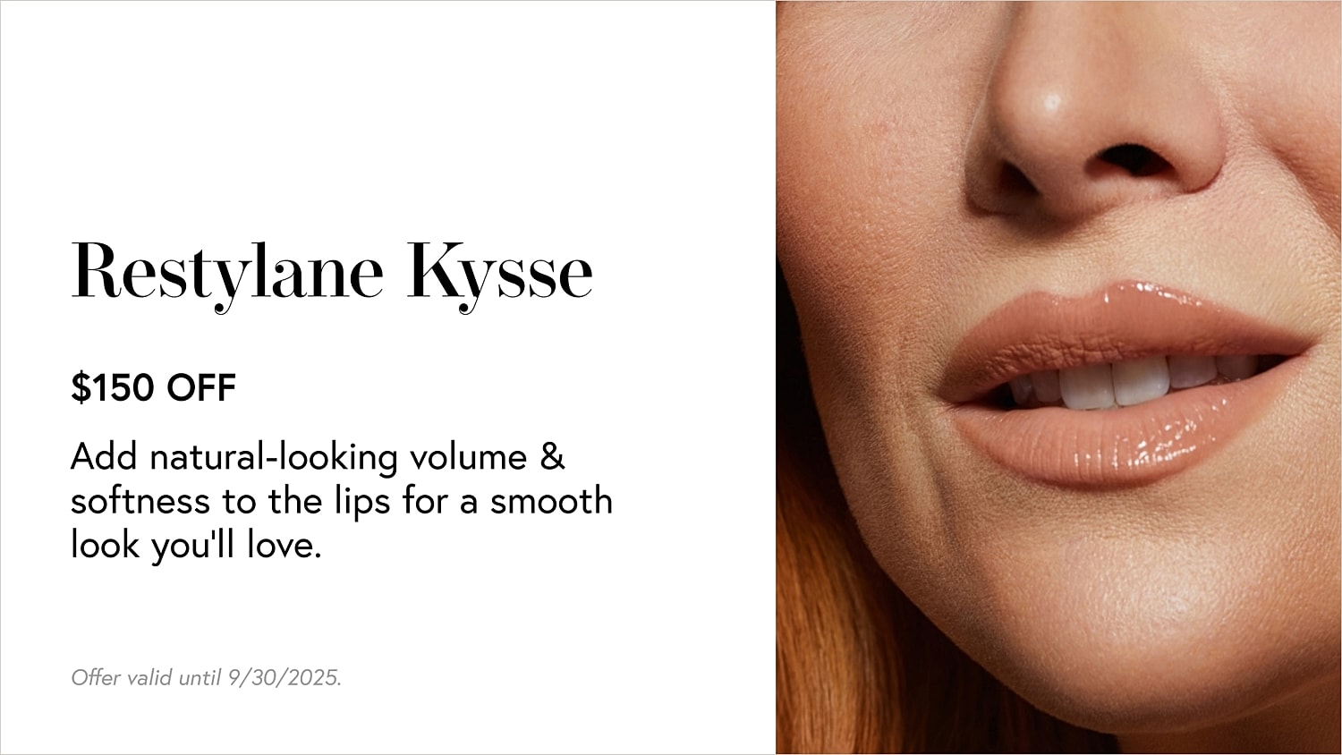 Restylane Kysse lip enhancement promotion details
